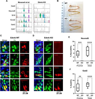 Ednrb−/− mice with hirschsprung disease are missing Gad2-expressing enteric neurons in the ganglionated small intestine